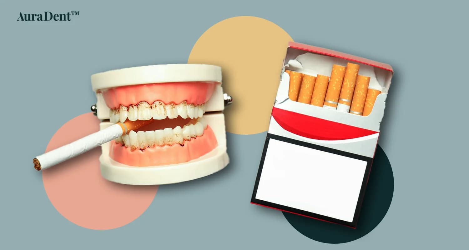 Detta foto visar en 3-d modell av en mun med en cigarett i, som visar förhållandet mellan cigaretter och dina tänder