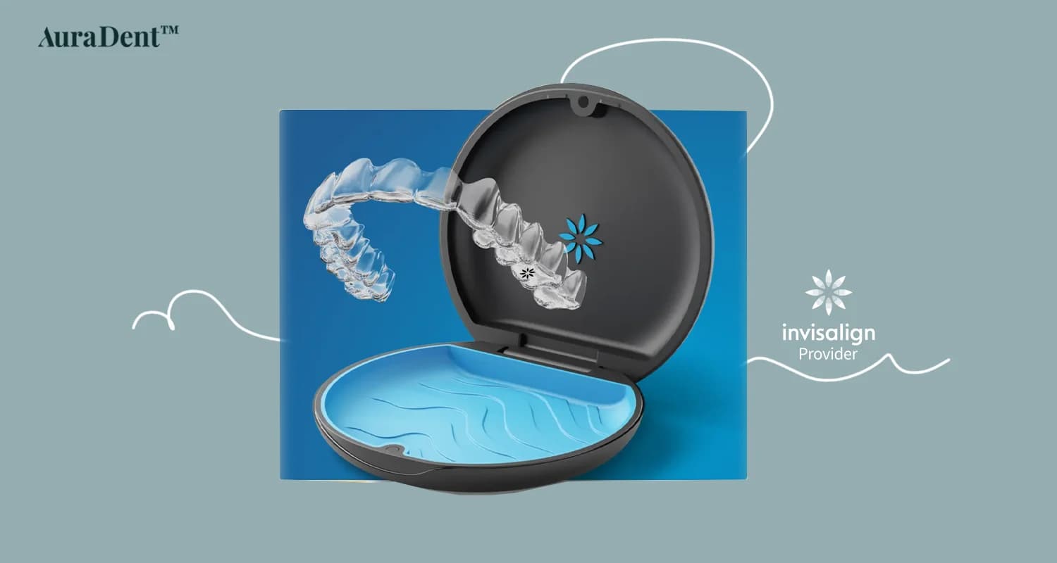 Detta foto visar ett tydligt aligner-fodral; invisalign för korsbett är en effektiv lösning