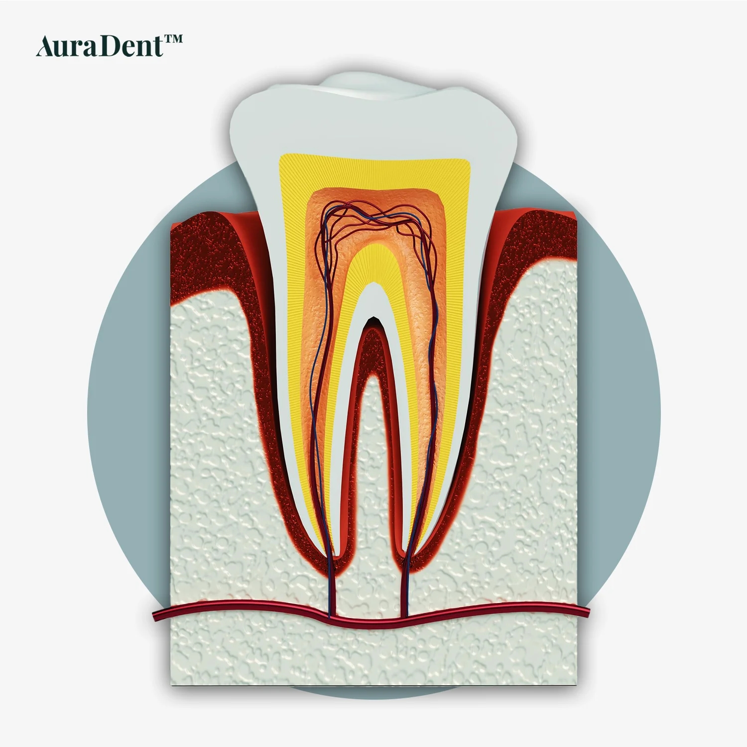 Rotfyllning (Rotbehandling): Den kompletta guiden från A till Ö