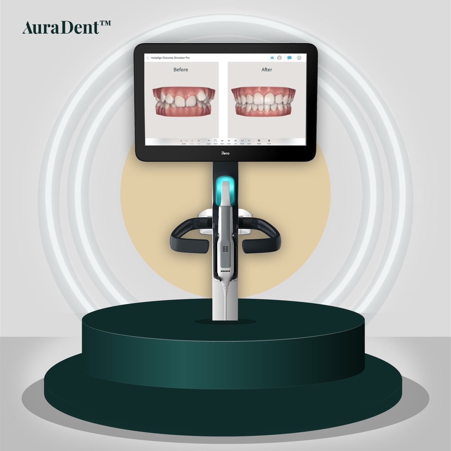 iTero 5D scanner: Din guide till modern digital tandvård