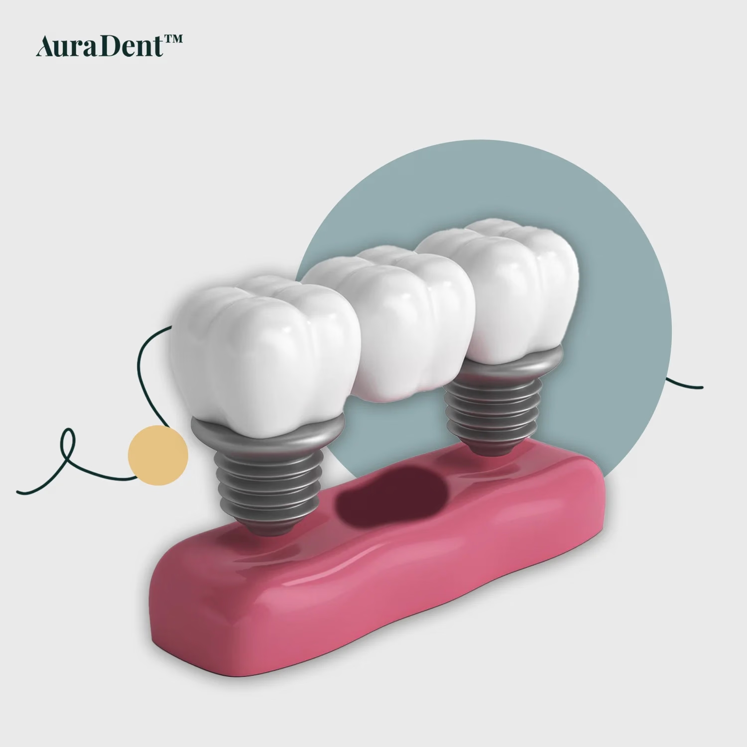 Alveolit and Infektion efter tandutdragning: Symtom, Läkningstid and Behandling
