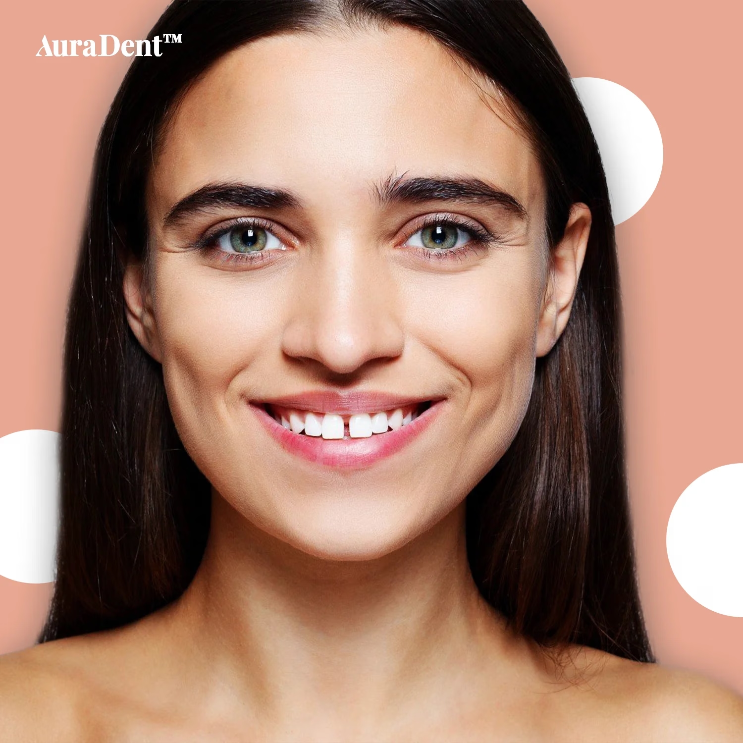 Invisalign för tandluckor: Stäng utrymmen mellan tänderna och få ett harmoniskt leende