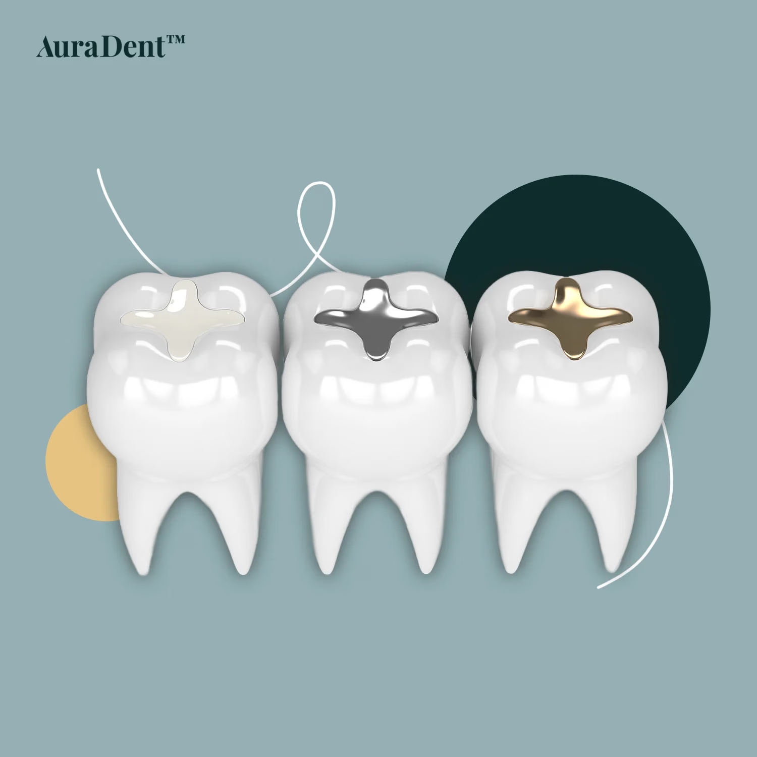 Allt om tandfyllning behandling material process och kostnad