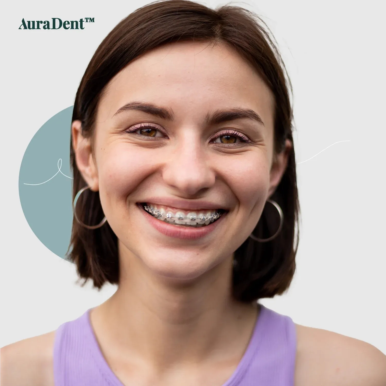 How Do Braces Work